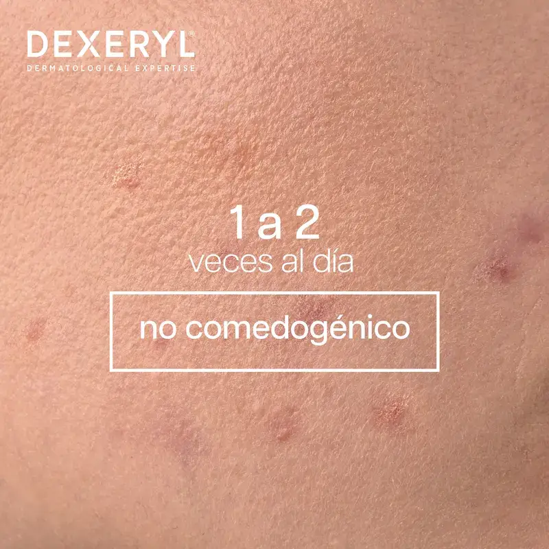Dexeryl Dexeclear Limpiador Calmante Hidratante , 400 ml - Imagen 5